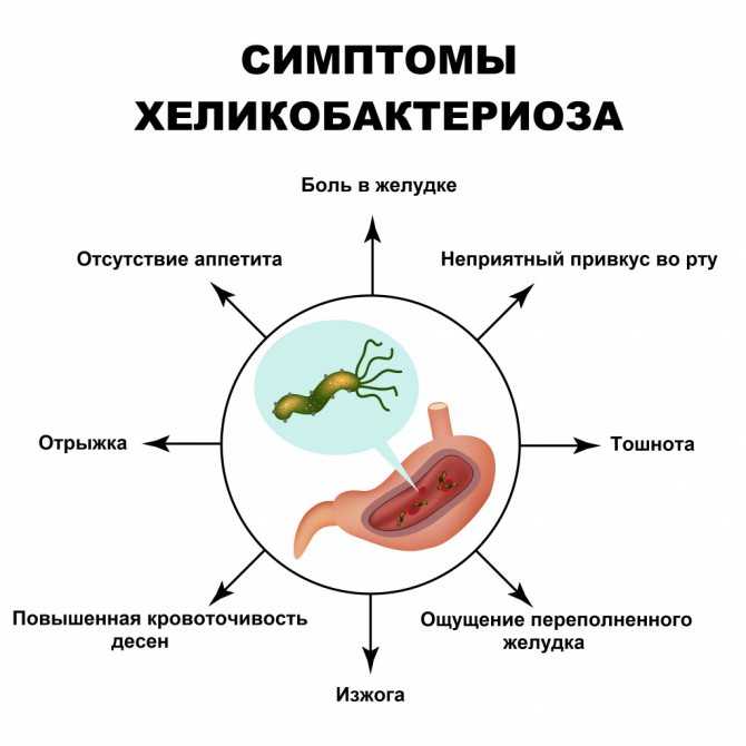 Язвенная болезнь желудка и 12-перстной кишки: гастрит, хеликобактер пилори, helicobacter pylori, медикаментозная язва, симптоматическая язва