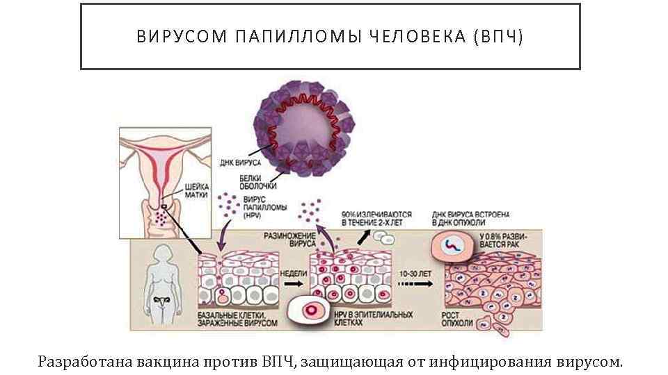 Вирус папилломы: признаки, типы и способы лечения