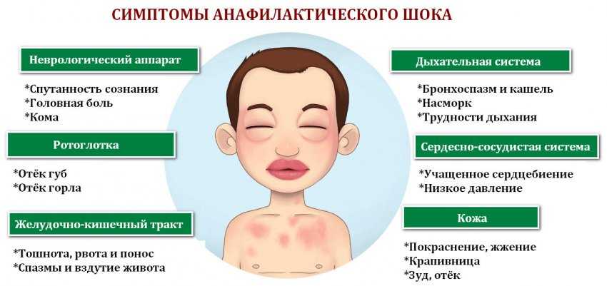 Сезонная аллергия (поллиноз) - причины, симптомы, лечение и диагностика сезонной аллергии в клинике целт