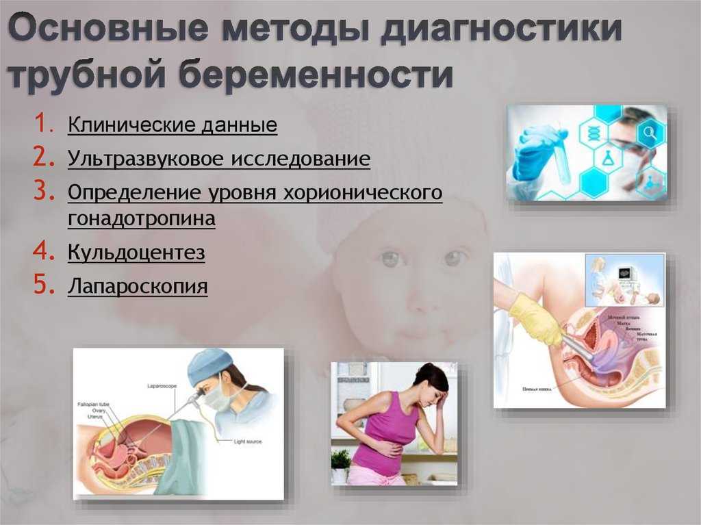 С клинической точки зрения выделяют прогрессирующую трубную беременность и нарушенную трубную беременность (разрыв маточной трубы, трубный аборт).