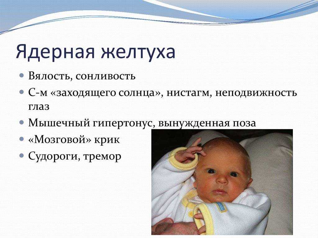 Желтуха новорожденных - симптомы и лечение