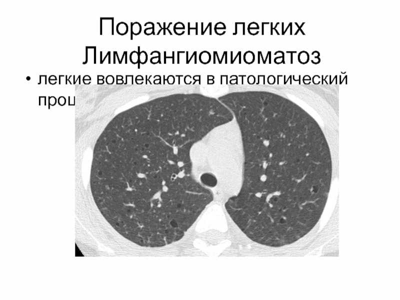 Дон24 - вирус поразил 70% легких: пациент больницы рассказал, как ростовские врачи спасают жизни больных
