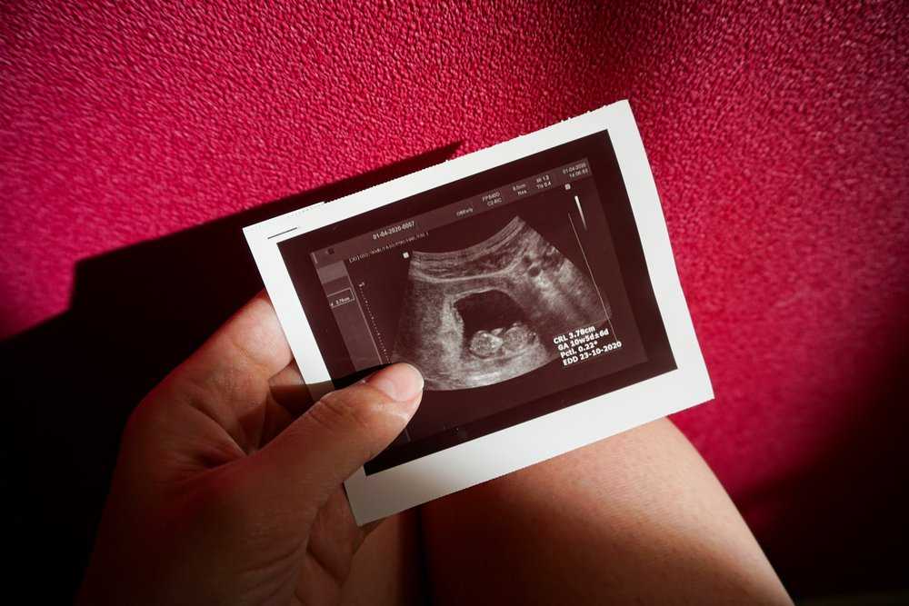 7 неделя беременности: развитие плода | pampers ru