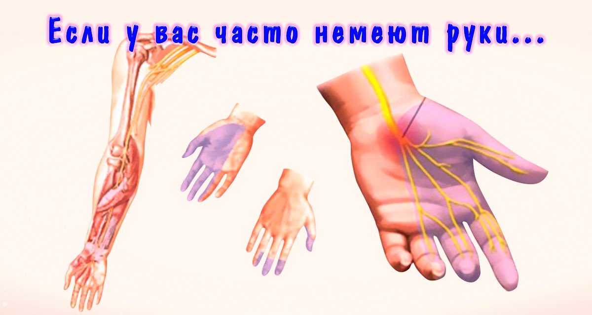 Онемение пальцев после операции. Онемение рук ,пальцев и ладони.