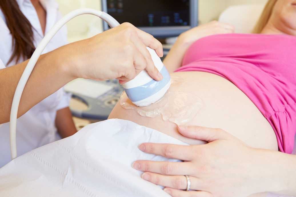Наращивание ресниц во время беременности: взвешиваем за и против