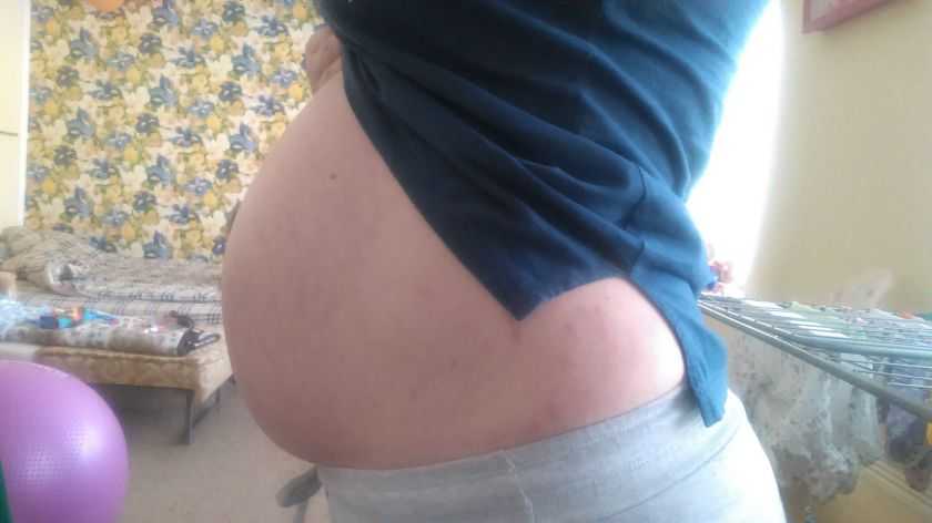 39 неделя беременности острая боль внизу живота при шевелении