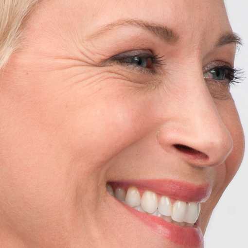 Морщины вокруг рта: 5 способов борьбы с кисетными морщинами в домашних условиях