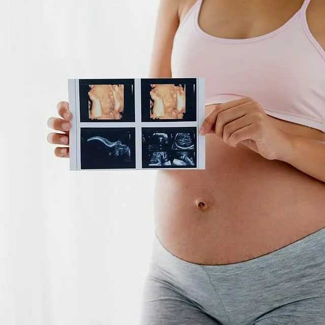 Скрининги во время беременности: что такое скрининг, сроки, на каких неделях делают | клиника «линия жизни»