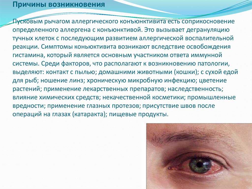 Аллергический конъюнктивит у детей - энциклопедия ochkov.net
