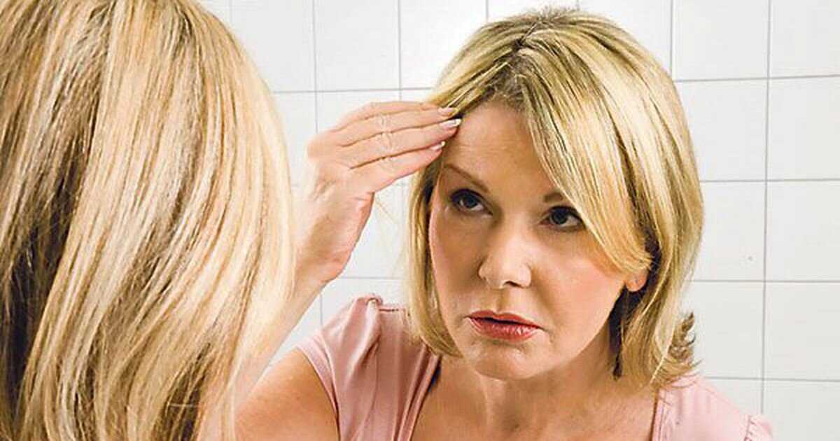 Выпадение волос на голове. причины частого выпадения волос