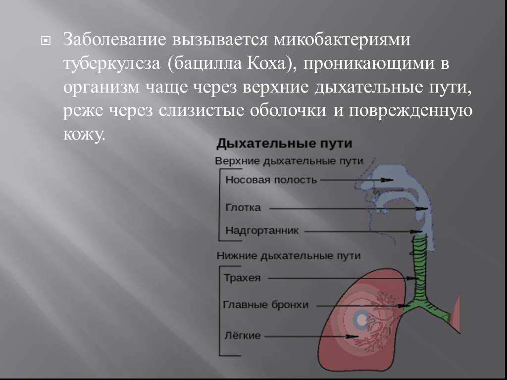 Слизистая оболочка дыхательных путей представлена. Заболевания верхних дыхательных путей. Туберкулез верхних дыхательных путей. Туберкулез верхних дыхательных путей презентация. Туберкулез органов дыхания презентация.