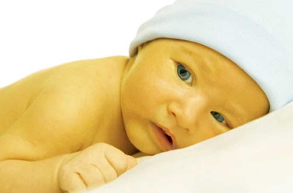 Физиологическая желтуха новорожденных