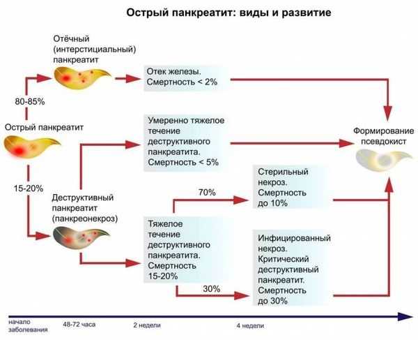 Острый панкреатит с госпитализацией: симптомы, диагностика, лечение