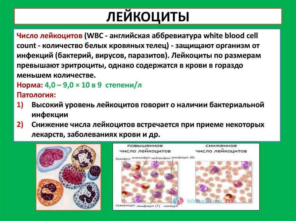 Лейкоцитурия - лейкоциты в моче | университетская клиника