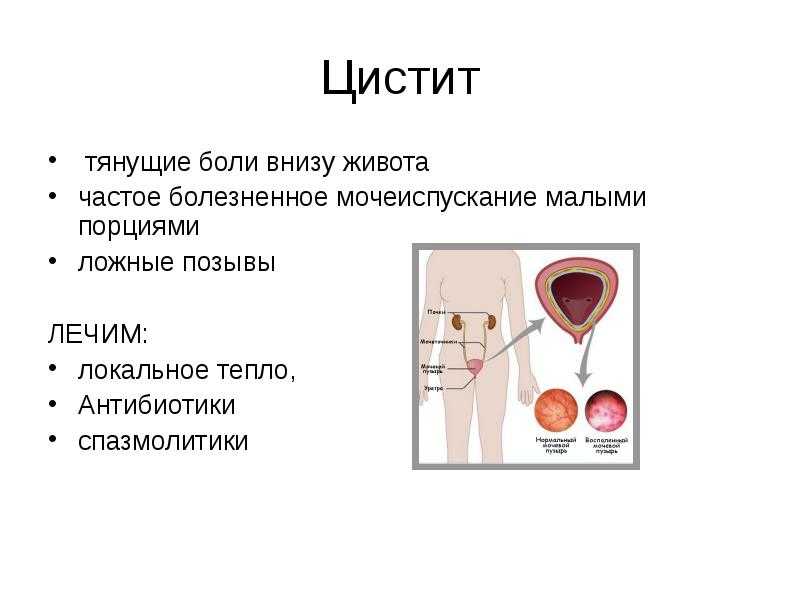 Лобный синусит (фронтит)