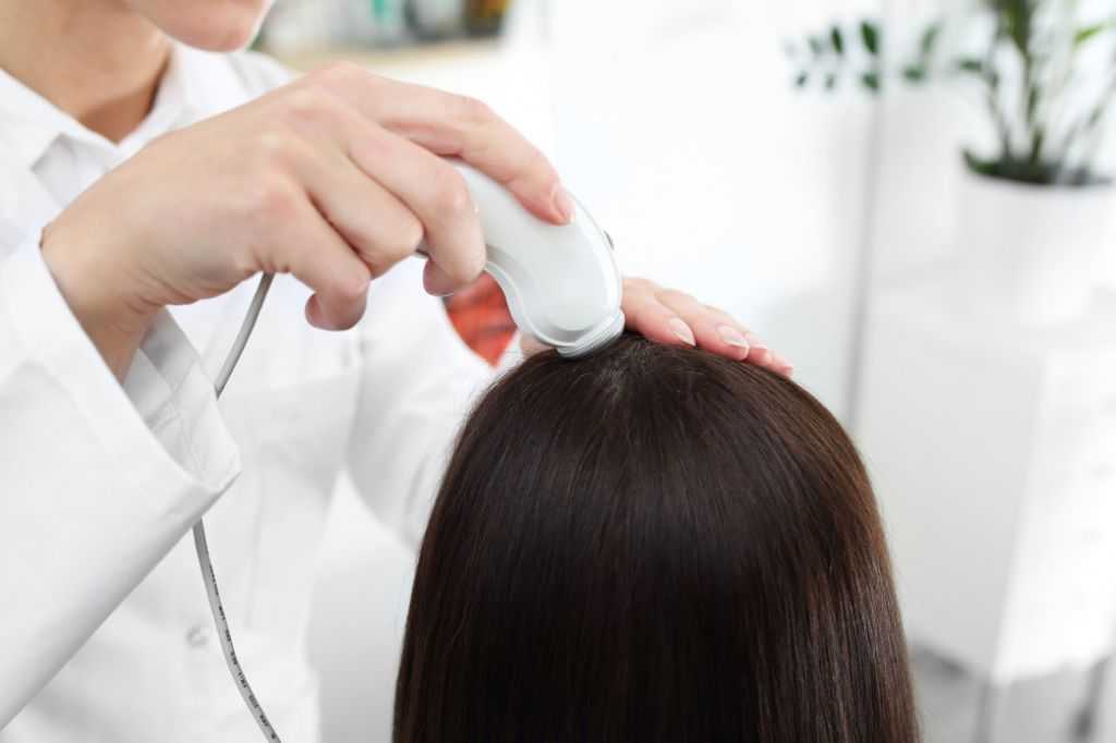 Жирная перхоть : причины, профилактика, лечение | средства для волос alerana